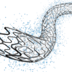 Drug Eluting Stent